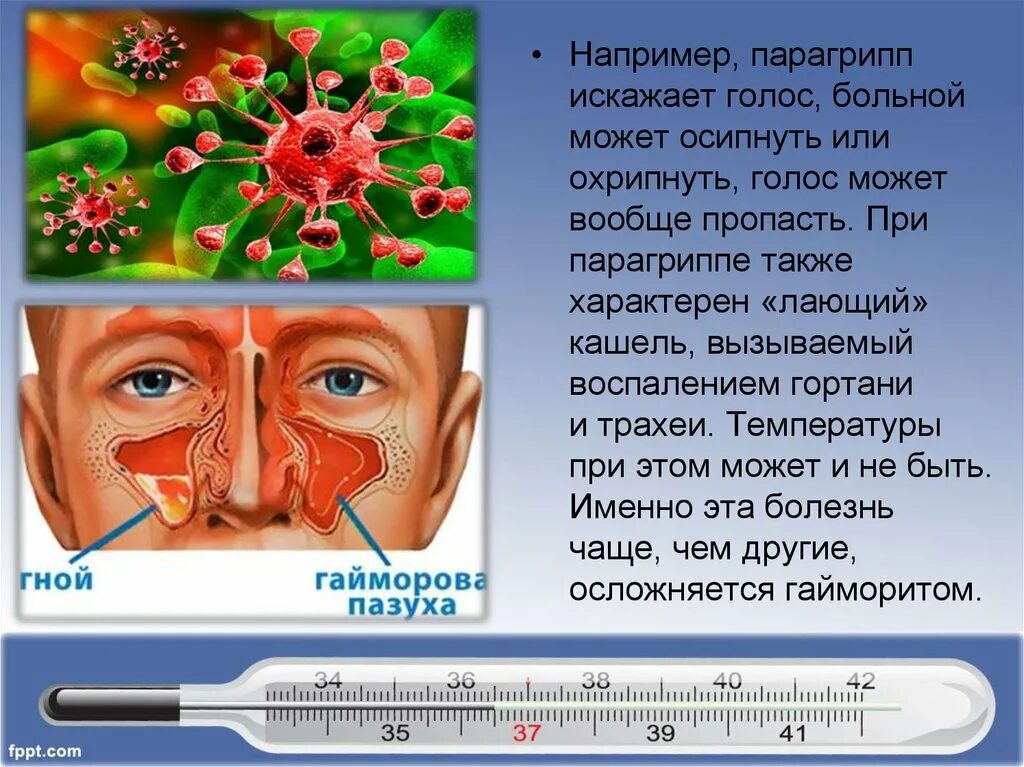 Парагрипп. Парагрипп симптомы. Парагрипп презентация. Парагрипп лающий кашель. Может ли осипнуть голос