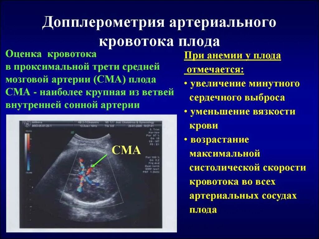 Как делают доплер. Допплерометрия сосудов плода. Средняя мозговая артерия допплер норма. УЗИ допплерография маточно-плацентарного кровотока.