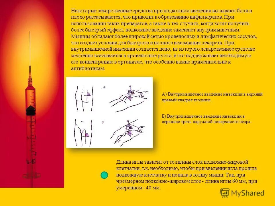оснащение для внутримышечной инъекции. при внутримышечной инъекции игла вводится. введение внутримышечной инъекции. техника проведения в/м инъекции. при внутримышечной инъекции игла вводится.