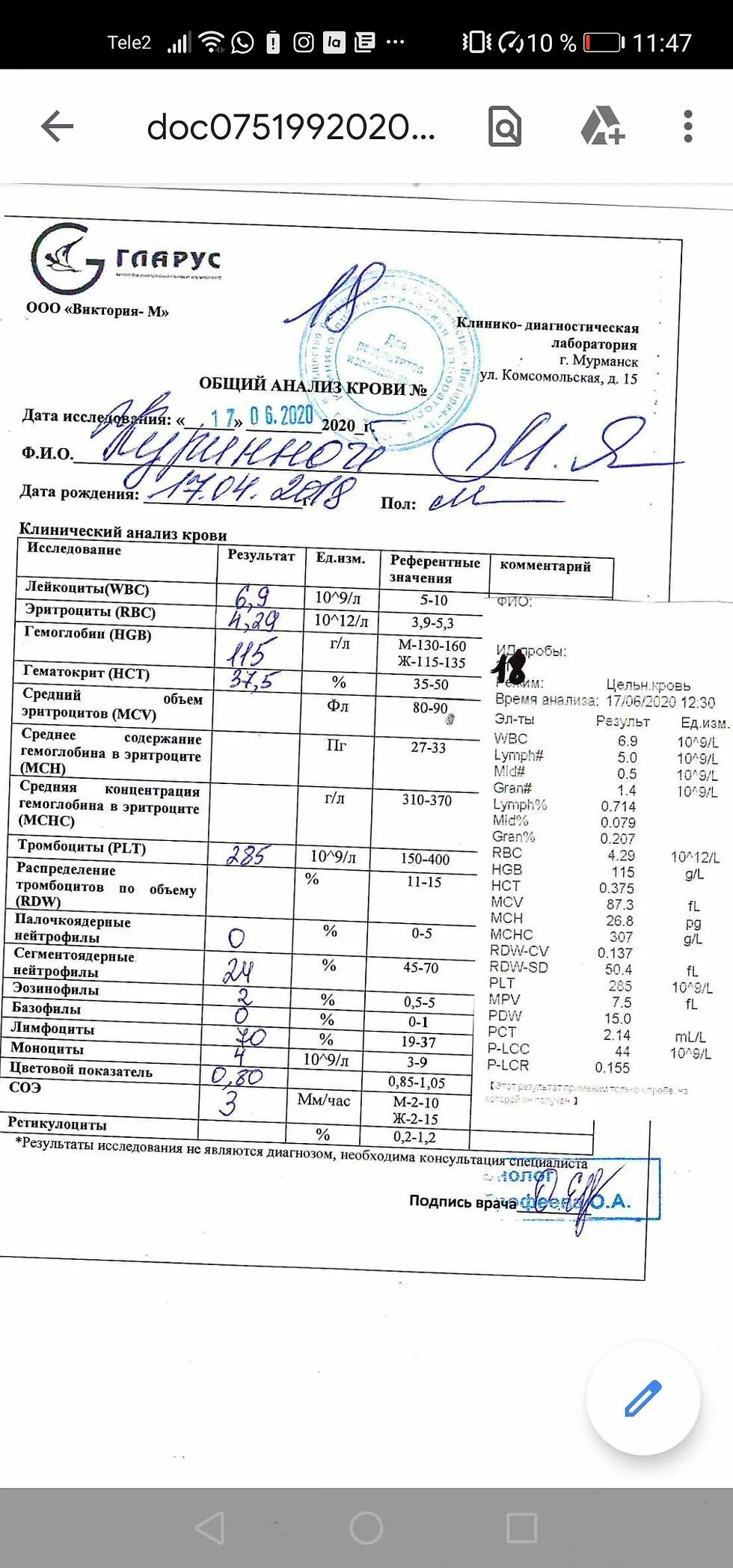 Результат анализа коклюш. Общий анализ крови из пальца. Общий анализ крови с лейкоформулой. Анализ крови при коклюше показатели. Общий анализ крови при коклюше у детей показатели.