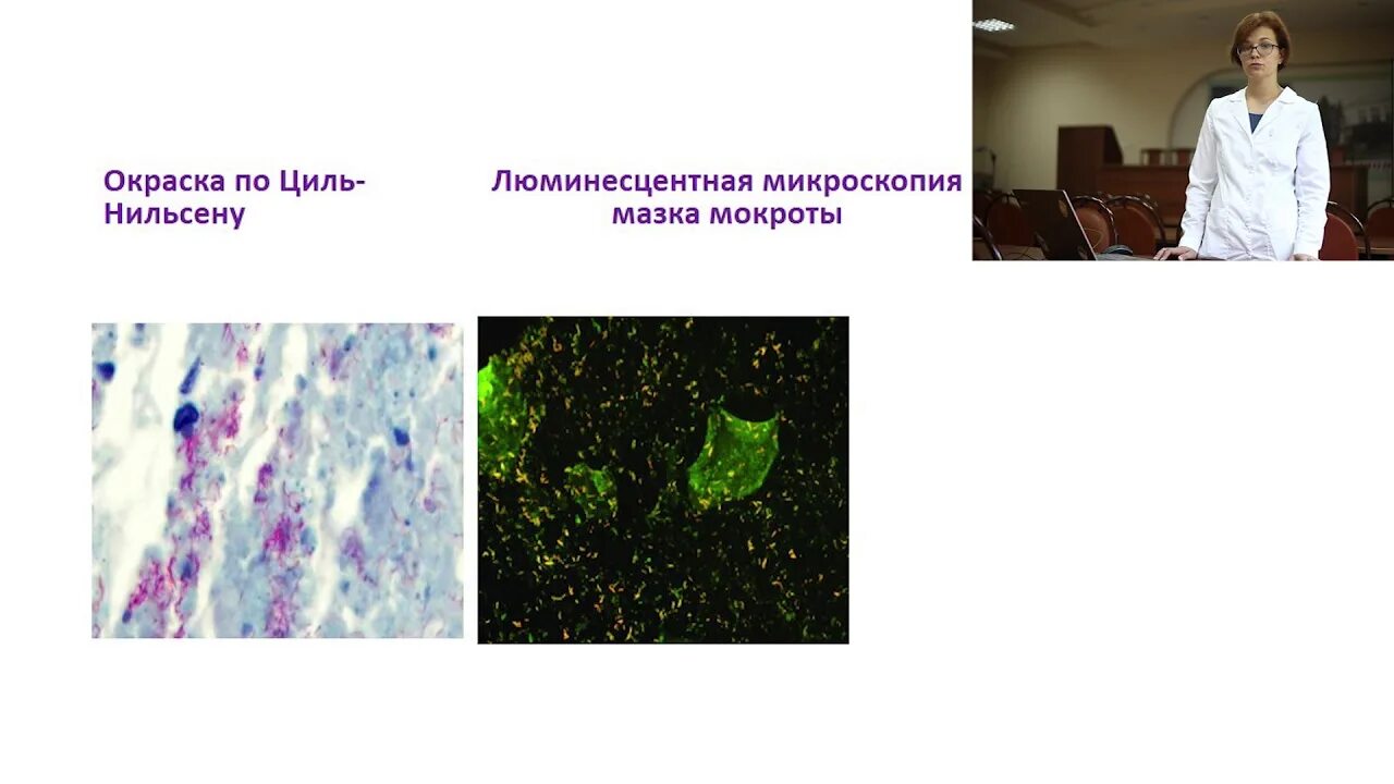 Мокрота по цилю нильсену. Микобактерии люминесцентная микроскопия. Люминесцентная микроскопия туберкулеза. Микобактерии туберкулеза люминесцентная микроскопия. Люминесцентная бактериоскопия при туберкулёзе.