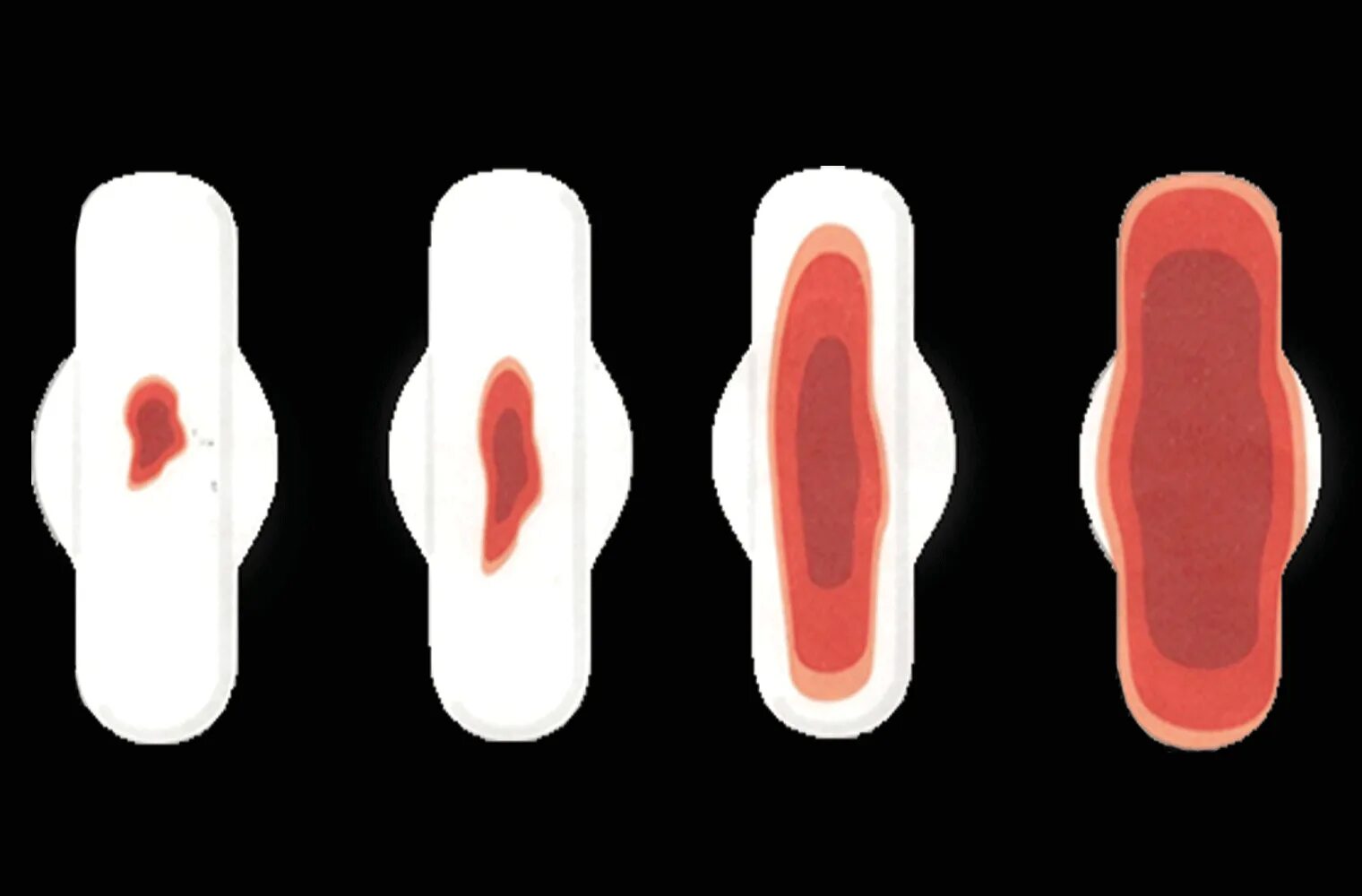 Овуляция половые губы. Обильность менструации. Месячные скудные и обильные. Как выглядит менструация. Менструальное кровотечение.