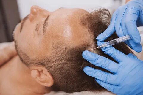 PRP hair treatment in Riyadh