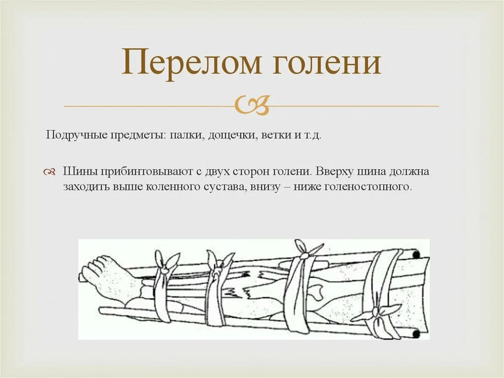 Перелом костей голени транспортная иммобилизация. Транспортная иммобилизация при переломе голени. Пелолом кости голени наложения жины. Перелом берцовой кости иммобилизация. При открытом переломе накладывают