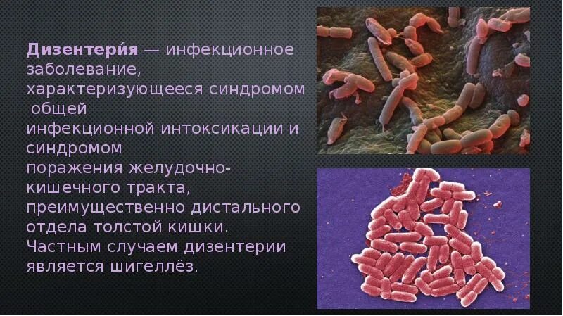 Дизентерия вирусное заболевание. Дизентерия возбудитель. Заболевание дизентерия. Дизентерия это инфекционное заболевание.