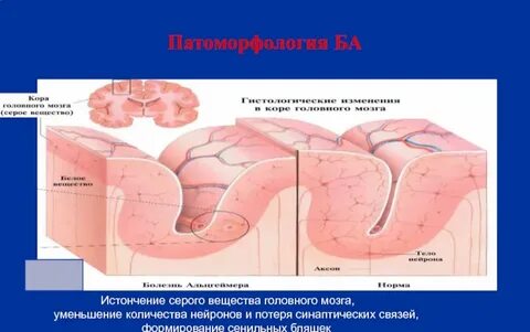 Патоморфология