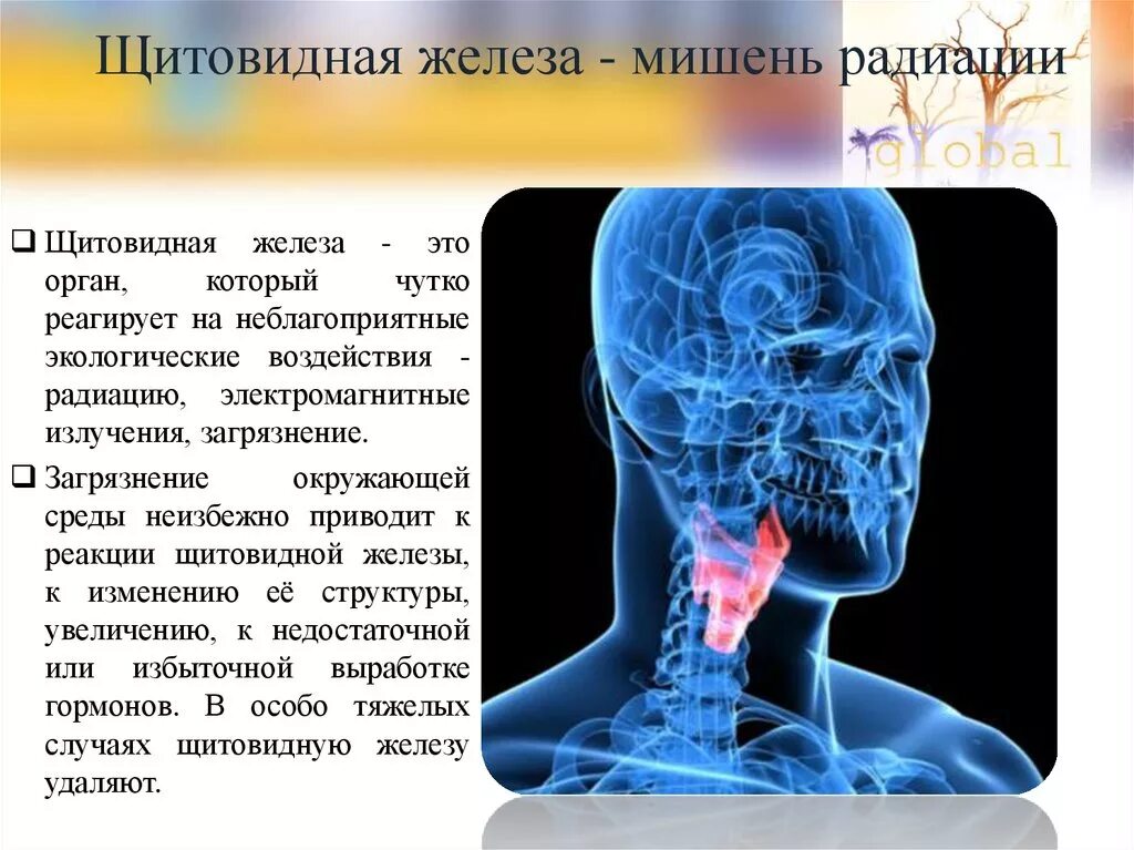 Орган мишень щитовидной железы. Щитовидная железа и радиация. Воздействие радиации на щитовидную железу. Влияние железа на щитовидную железу.