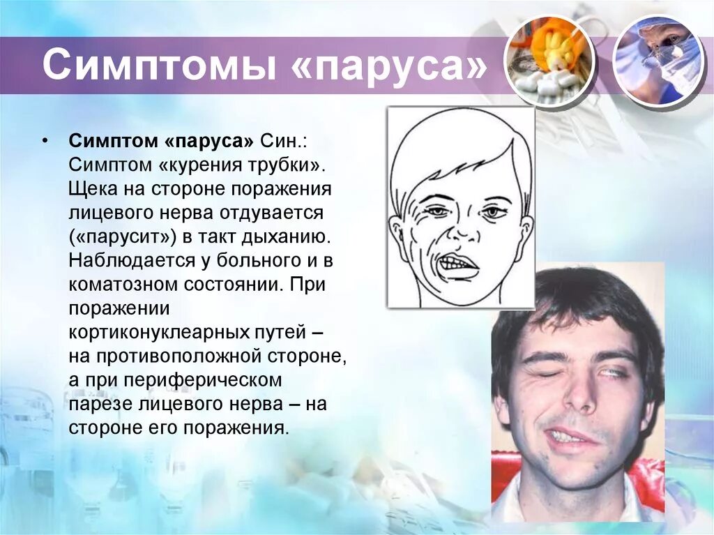 Щека на щеку спид ап. Симптом паруса.