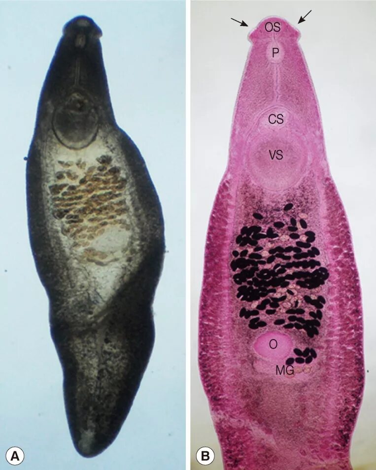 Двуустка печеночный сосальщик. Черви сосальщики. Трематоды Кошачья двуустка.