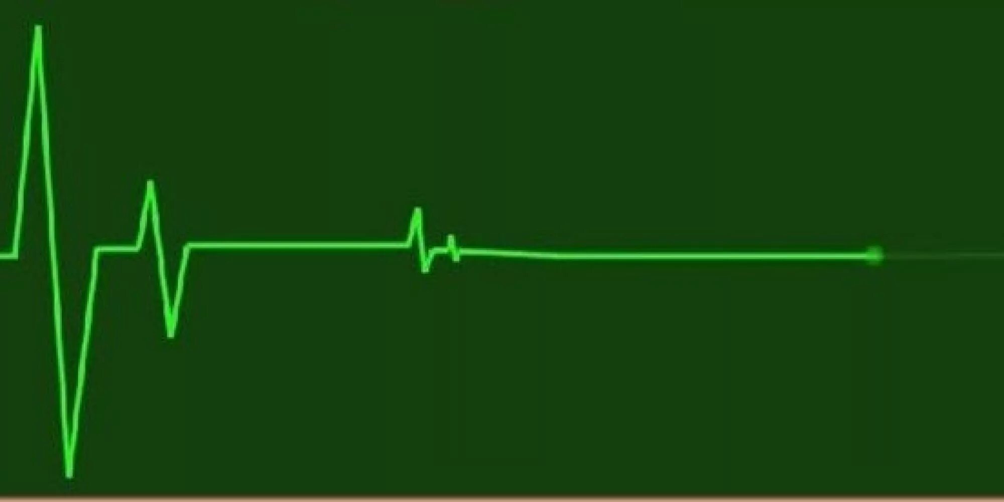 Сердцебиение остановилось. Прямая линия на кардиограмме. Пульс остановка сердца. Линия пульса.