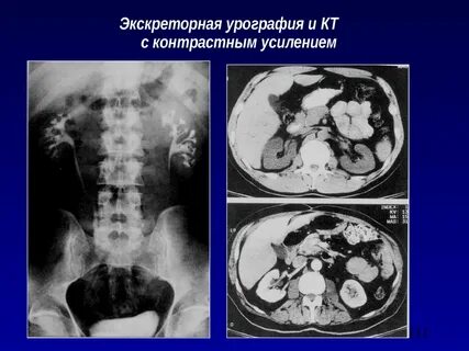 Кт без контрастного вещества