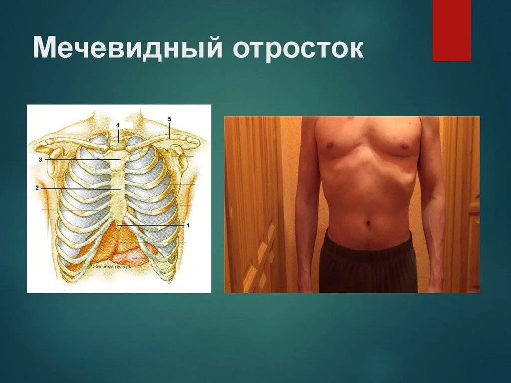 Расходятся ребра