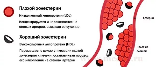 Холестерин. Плохой холестерин. Повышение уровня холестерина. Уровень плохого холестерина.