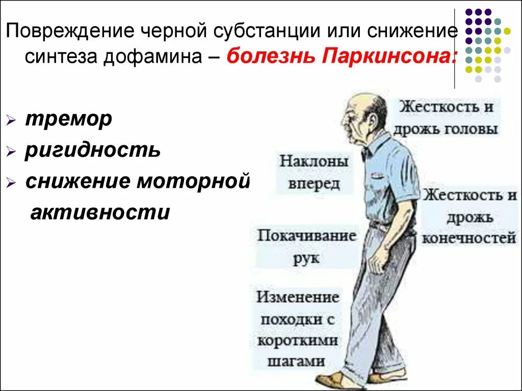 Болезнь Паркинсона черная субстанция. Поражение черной субстанции симптомы. Клинические симптомы болезни Паркинсона. Болезнь Паркинсона поражение.