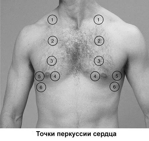Что значит расширен поперечник сердца. Что значит расширен поперечник сердца