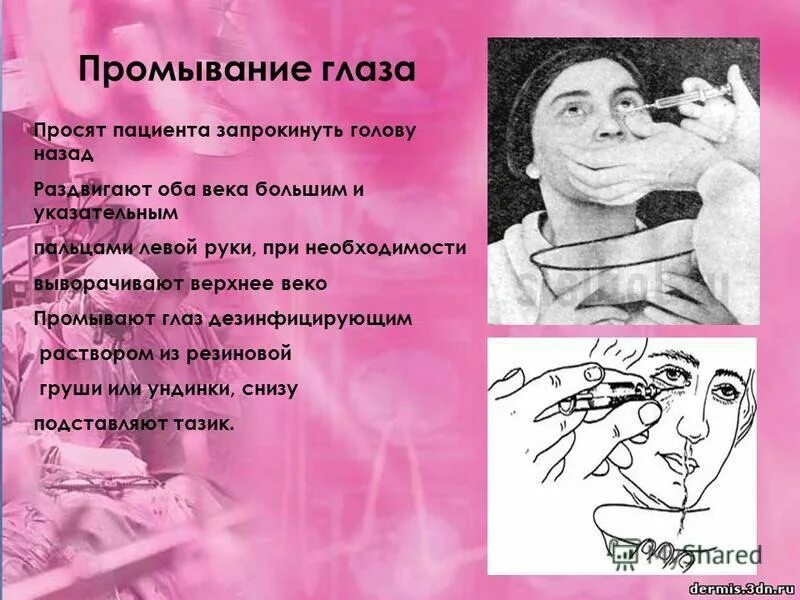 глаза промывают раствором