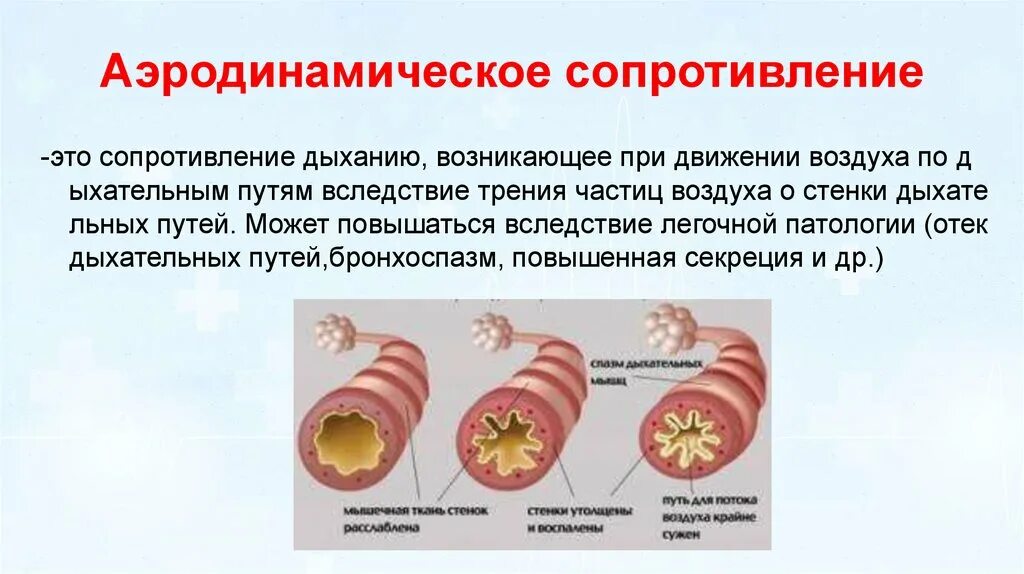 Аэродинамическое сопротивление. Аэродинамическое сопротивление дыхательных путей. сопротивление аэродинамика. донное сопротивление аэродинамика.