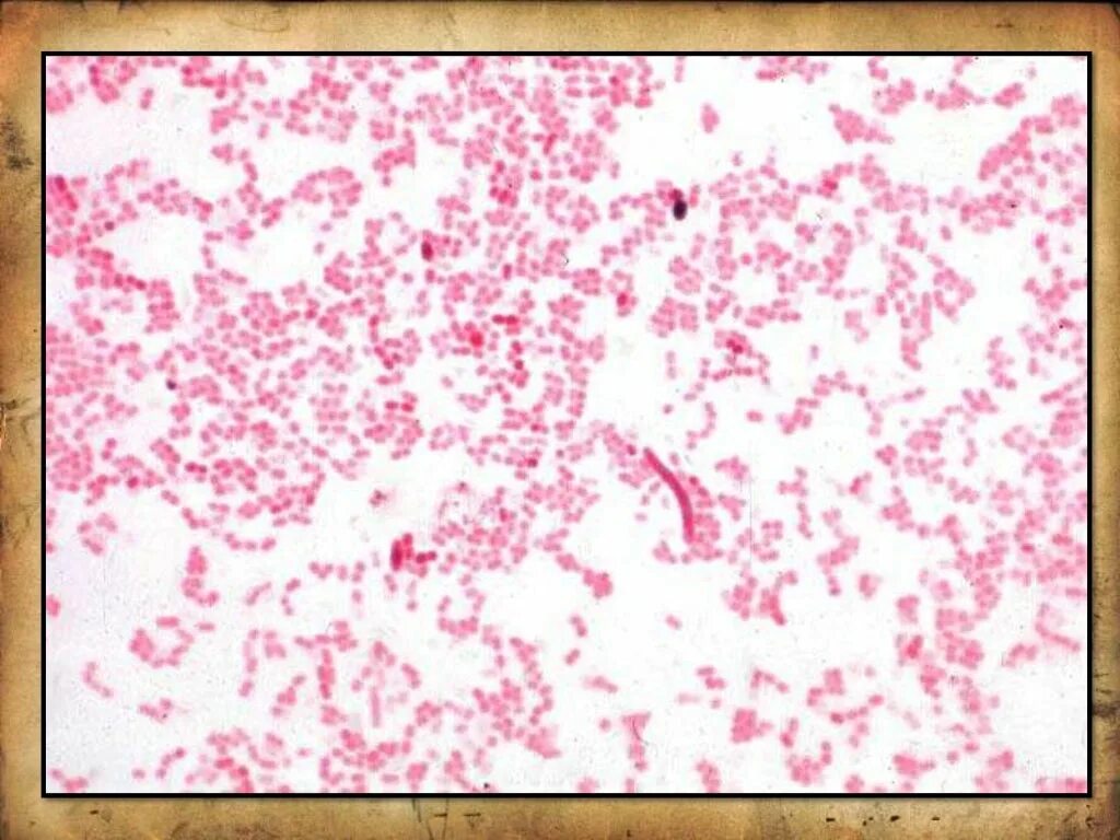 Haemophilus в мазке у мужчин. Моракселла Бовис. Моракселла грамотрицательные. Моракселлы микробиология.