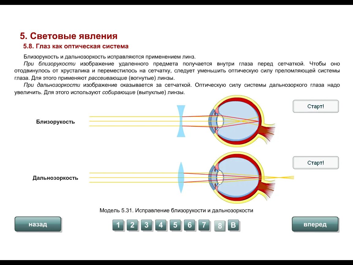 Глаз как оптическая система физика. Глаз как оптическая система схема. Глаз как оптическая система близорукость и дальнозоркость. Строение глаза как оптической системы.