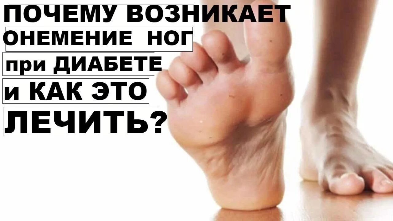 Почему немеет холодная нога. Немеют пальцы на ногах при сахарном диабете. стопа при сахарном диабете. онемение ног при диабете. лекарство от онемения пальцев ног.