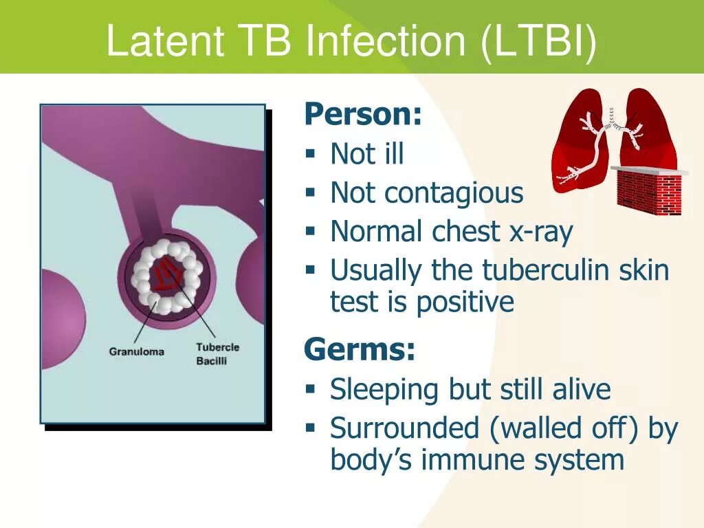 Латент. Infection English. Tuberculosis transmission.