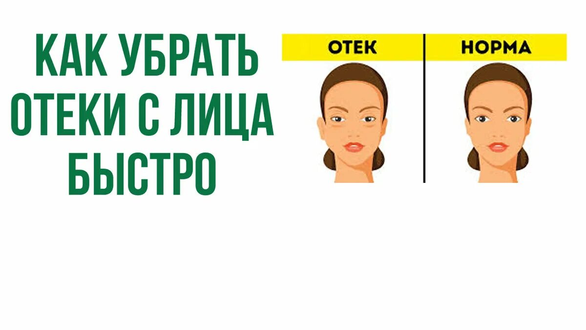 Снять отёки с лица быстро. Как быстро убрать отек лица утром