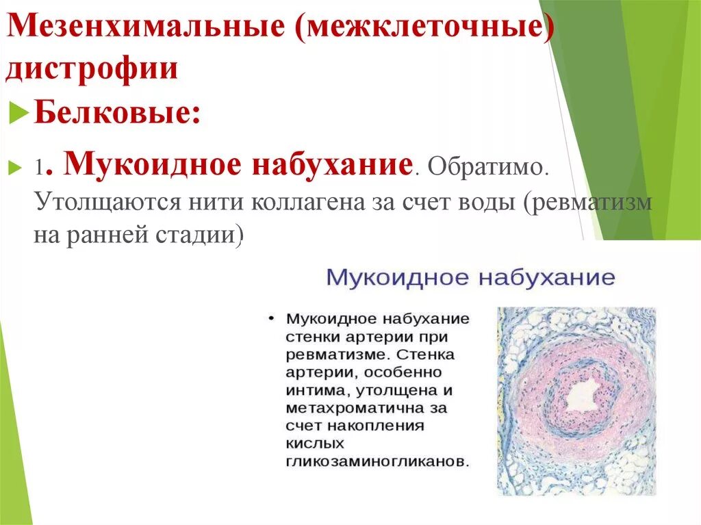 Белковые мезенхимальные дистрофии. Мезенхимальные дистрофии мукоидное набухание. Белковые мезенхимальные дистрофии таблица мукоидное набухание. Белковые мезенхимальные дистрофии мукоидное набухание. Белковые мезенхимальные дистрофии таблица.