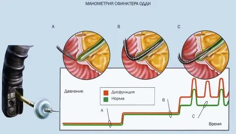 Сфинктер сжимался