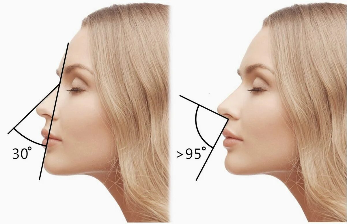 Портрет фас анфас профиль. Нос с горбинкой у девушки. Формы носа у женщин. Как понять профиль. Прямой нос у женщин.