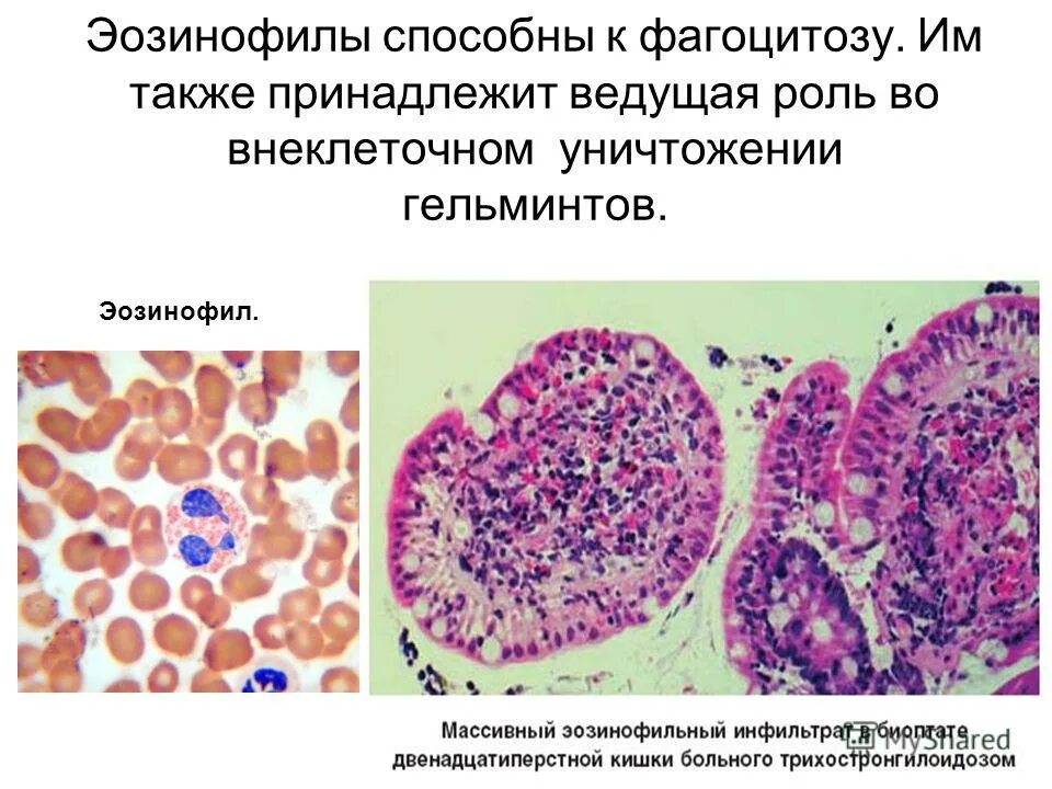 фагоцитоз это процесс поглощения. способны к фагоцитозу. эозинофилы фагоцитоз. б способны к фагоцитозу. фагоцитоз фагоцитирующие клетки.