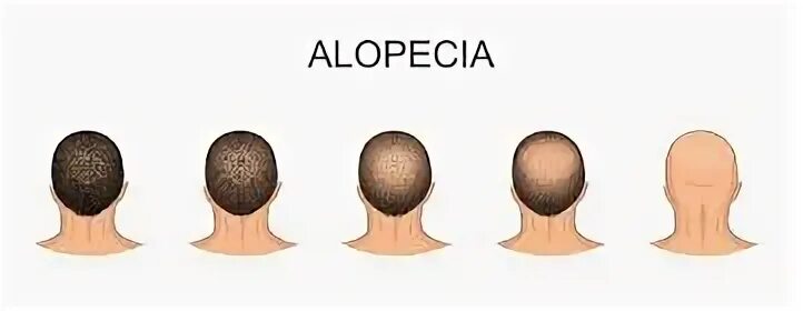 Толщина волос на голове