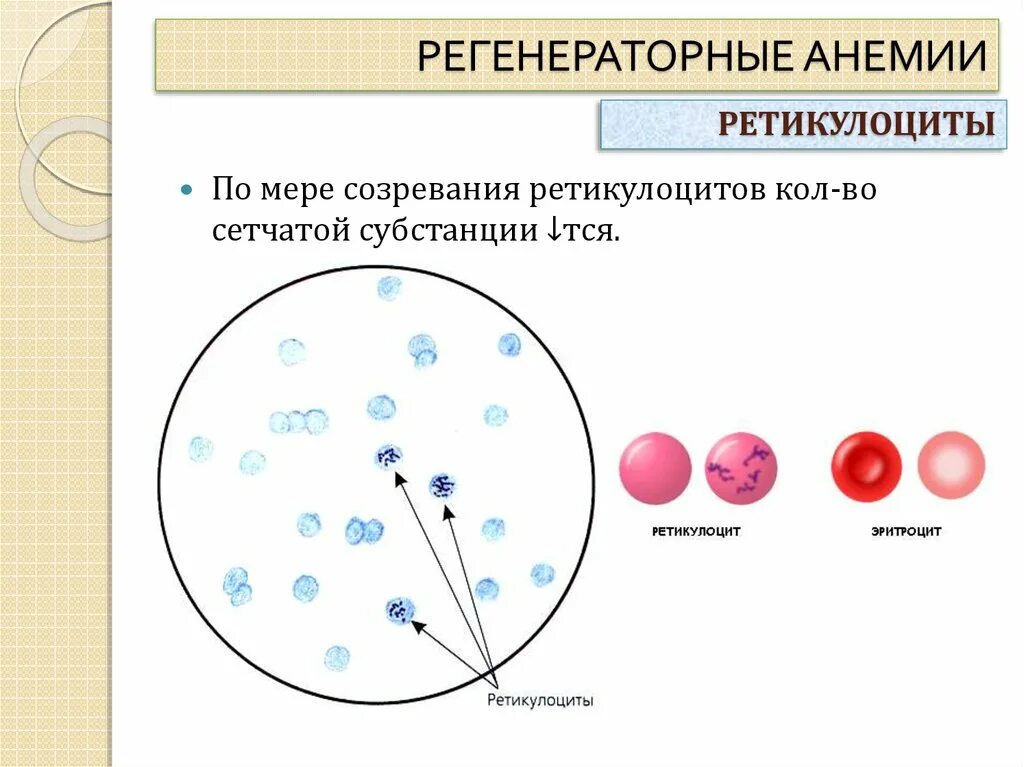 Уровень ретикулоцитов. Регенераторная анемия ретикулоциты. подсчет ретикулоцитов крови при анемиях.. повышение уровня ретикулоцитов в крови характерно для.