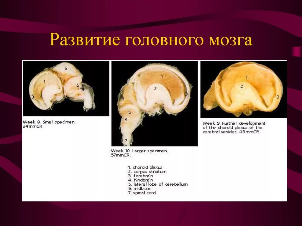 Нарушение развития головного мозга. Развитие головного мозга. Стадии развития головного мозга. Стадии раннего развития головного мозга. Этапы развития области головного мозга.