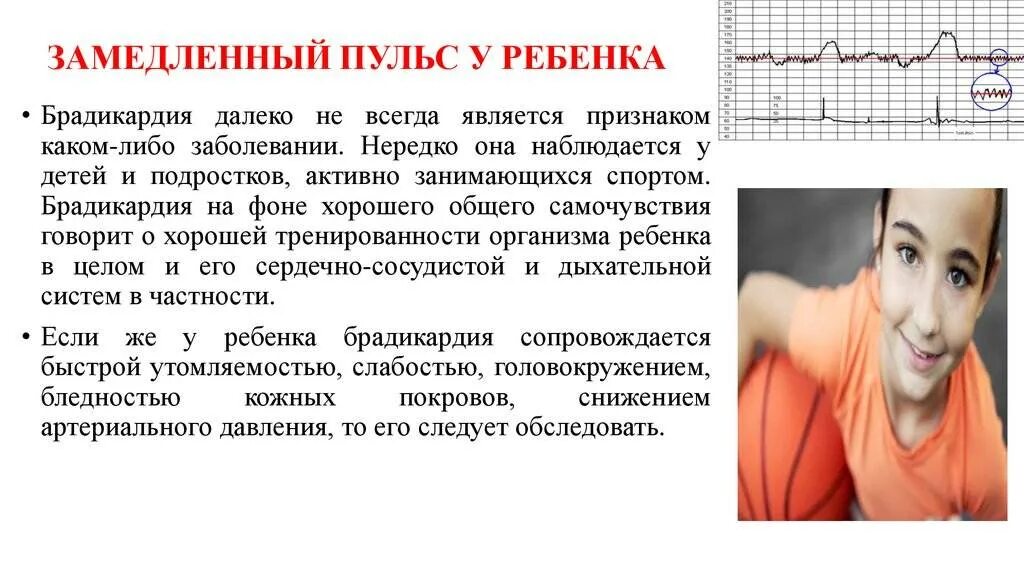 Пульс. Брадикардия сердца у подростка. Как замедлить сердцебиение. Пульс больного человека.