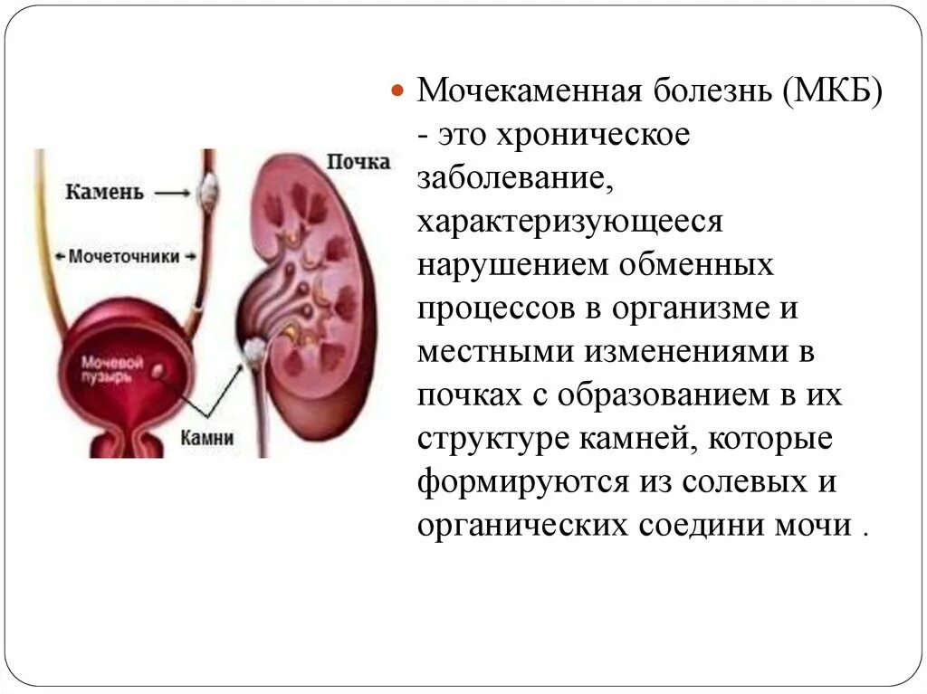 Заболевания мочеточника