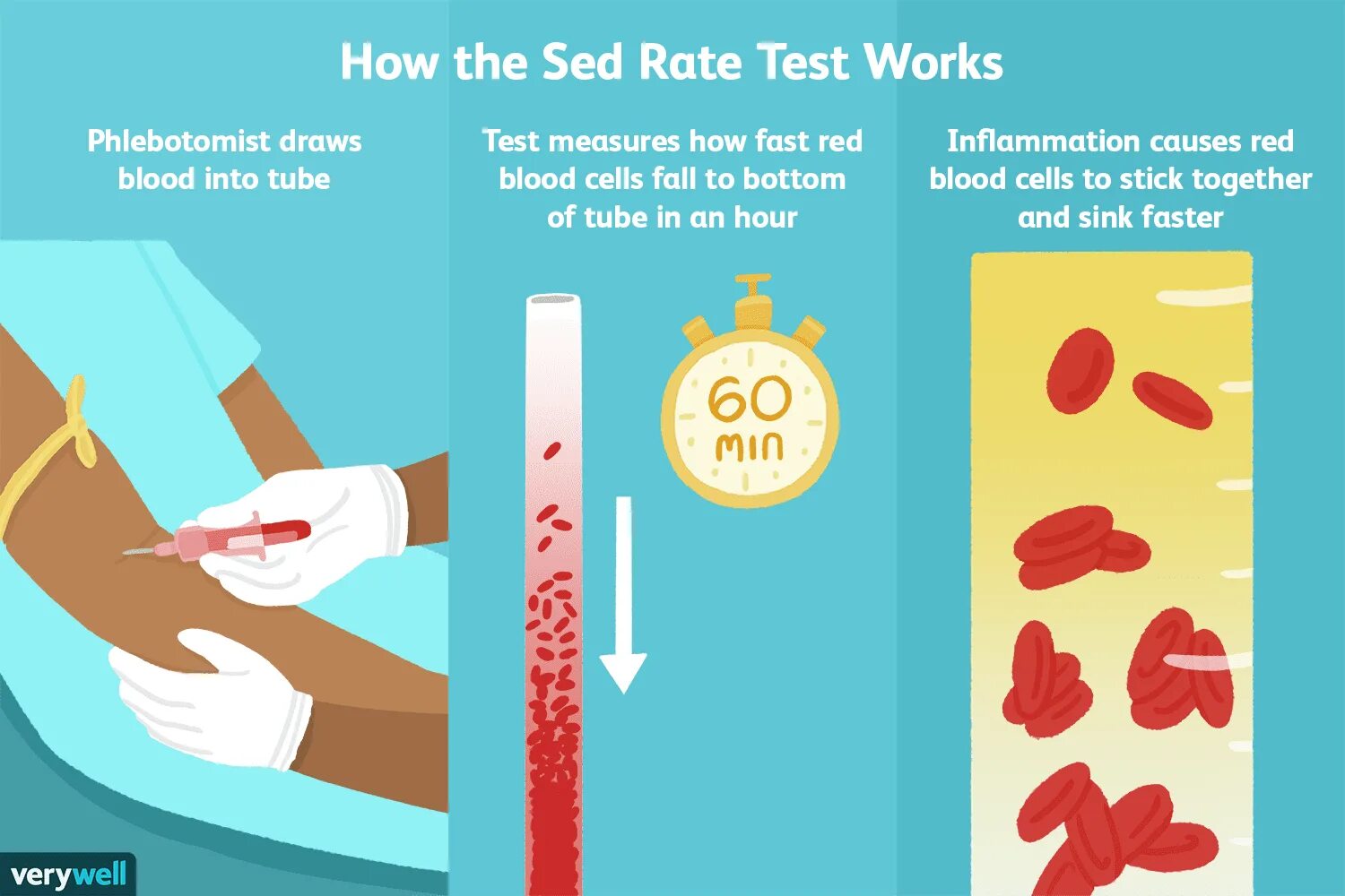 Blood pressure range. Esr blood normal. Sphincter flow secure. Blood rate. Bp normal.