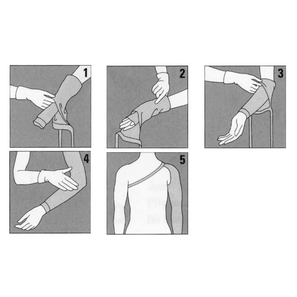 Компрессионный трикотаж на верхнюю конечность. Рукав sigvaris без перчатки advance av2-bez с силиконовой лентой, противоотечный, 2 класс. Компрессионный рукав при лимфостазе после мастэктомии. Venoteks компрессионный рукав. Как носить компрессионный рукав.