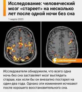 Сон активность
