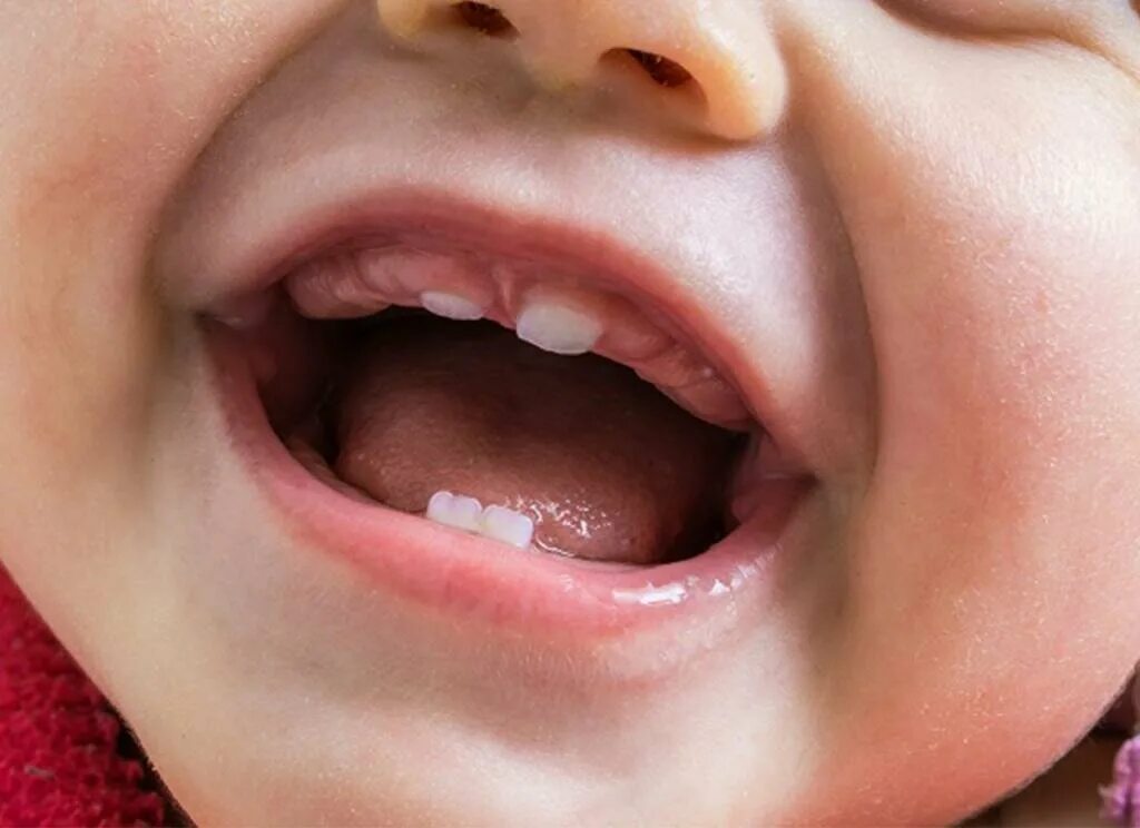 5 месяц ребенок зубы температура. Прорезывание зубов у грудничков.