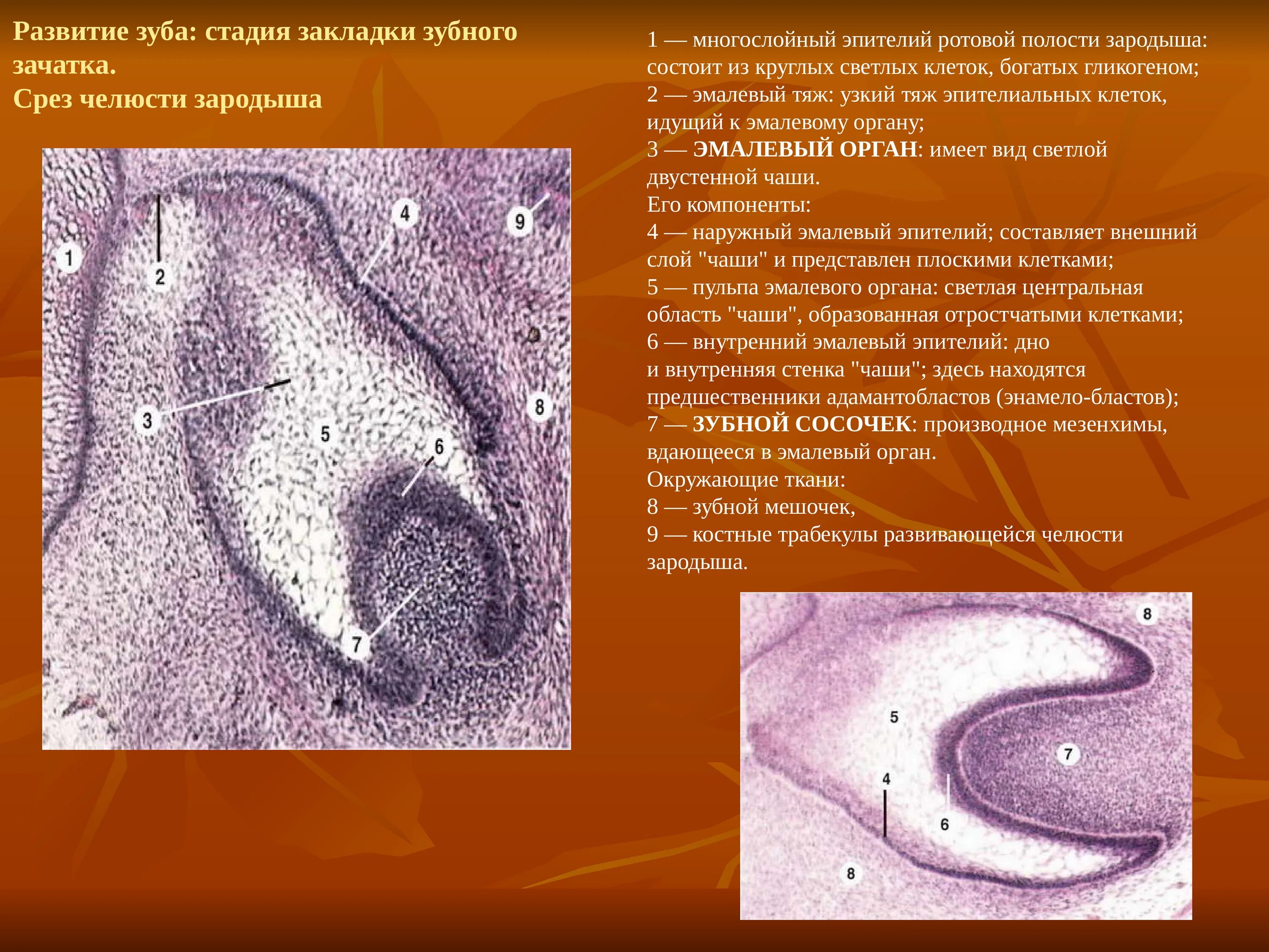 Стадии развития зуба. Гистогенез зуба гистология. Ранняя стадия развития зуба гистология. Стадии развития зуба гистология препараты. Закладка зуба гистология.