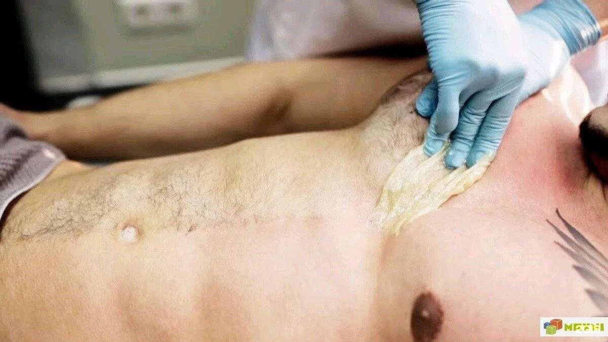 Waxing brazilian men. Waxing brazilian men. Man waxing bikini. Мужской шугаринг. Waxing brazilian men.