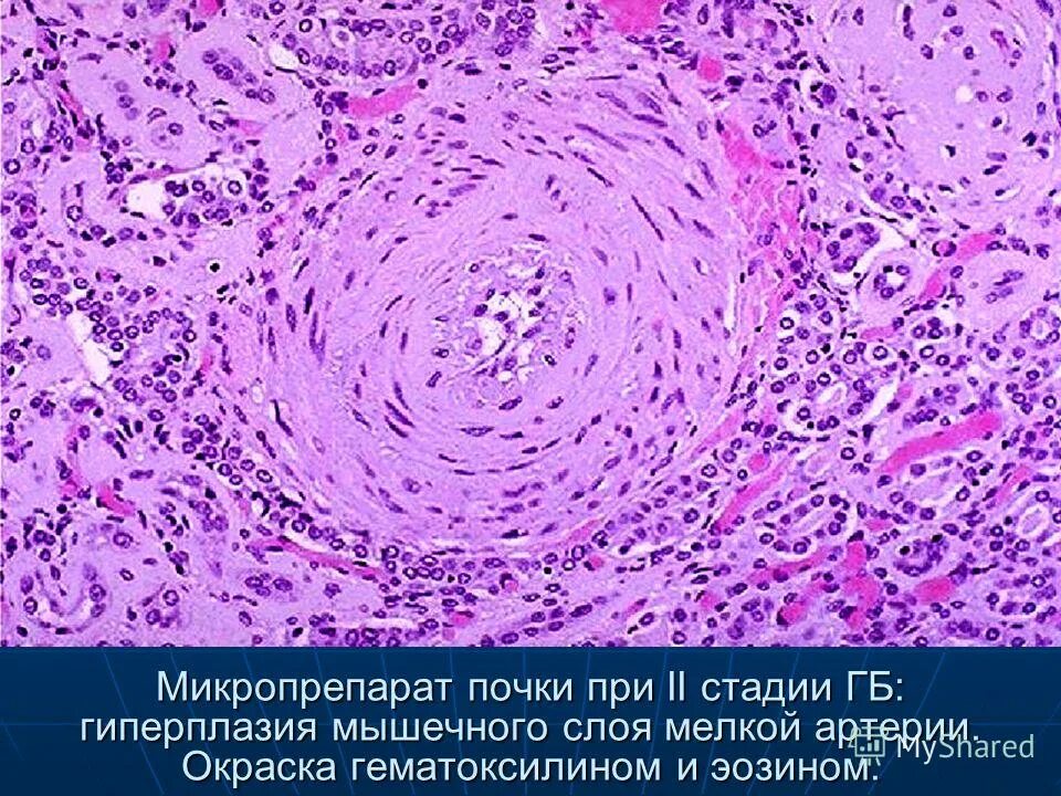 Патан пф