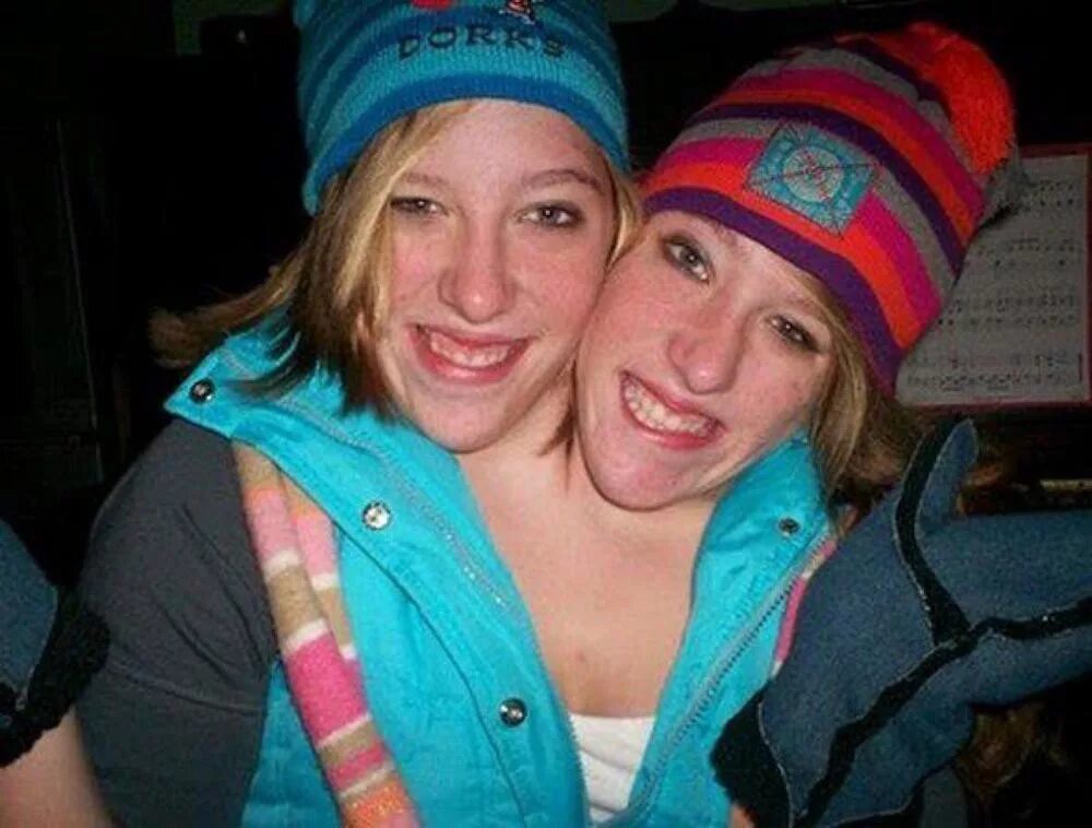 Сестры британи и эбигейл. Близнецы с двумя головами. Близнецы с двумя головами. Сёстры хенсел сиамские близнецы. Сестры британи и эбигейл.