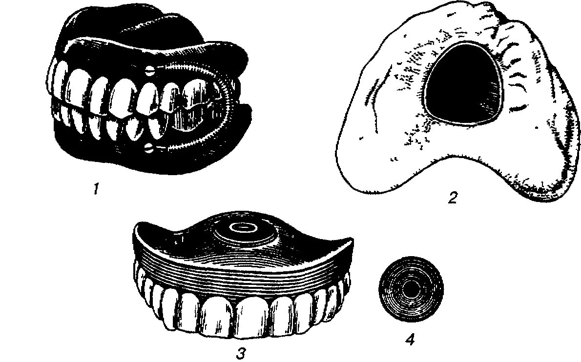 Границы пластиночного протеза. Кламмер Кемени. Механические способы фиксации протезов. 1. Механические методы фиксации полных съемных пластиночных протезов. Биомеханические методы крепления протезов.