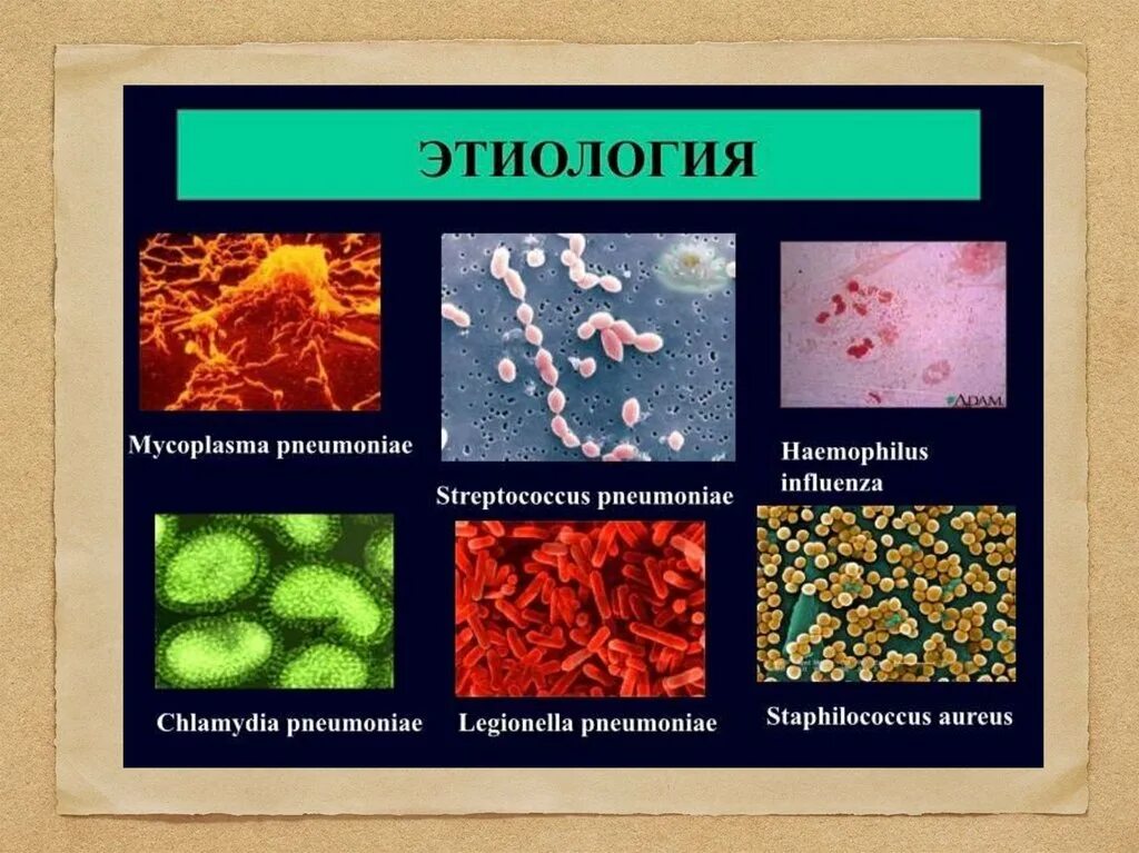 Какие возбудители вызывают пневмонию. Этиология пневмонии. Этиологические факторы пневмонии. Пневмония этиология и патогенез. Возбудители пневмонии.