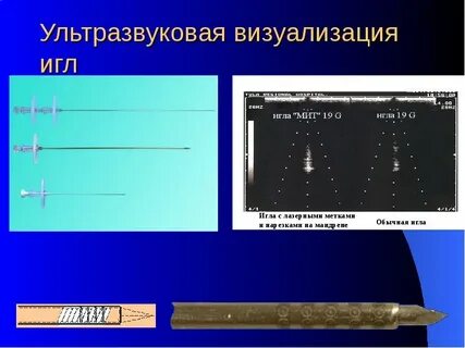 Ультразвуковая визуализация