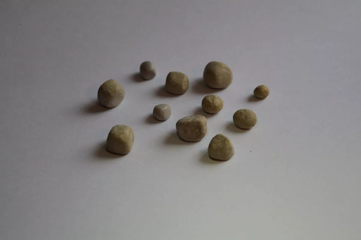Камень в почках 2 мм. Камень из почки круглый. Цвет и форма почечных камней.