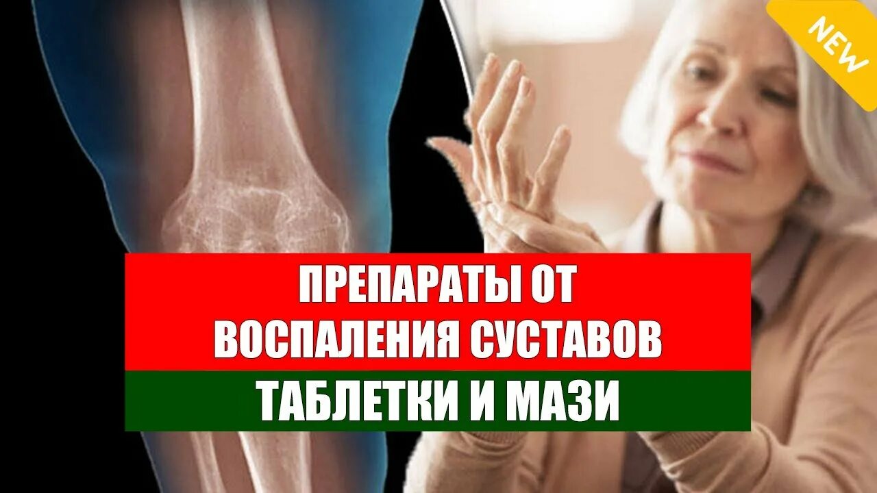 Препараты при артрите и артрозе суставов