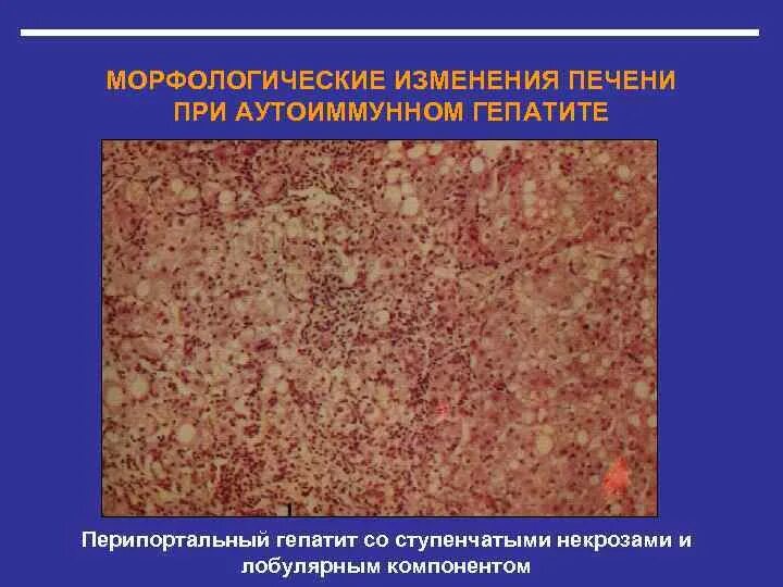 Изменение тканей. Изменение тканей