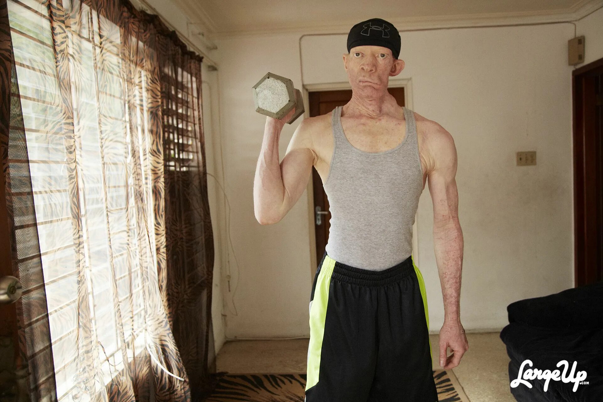 Yellowman певец. Yellowman регги. Винстон Фостер Yellowman. Yellowman